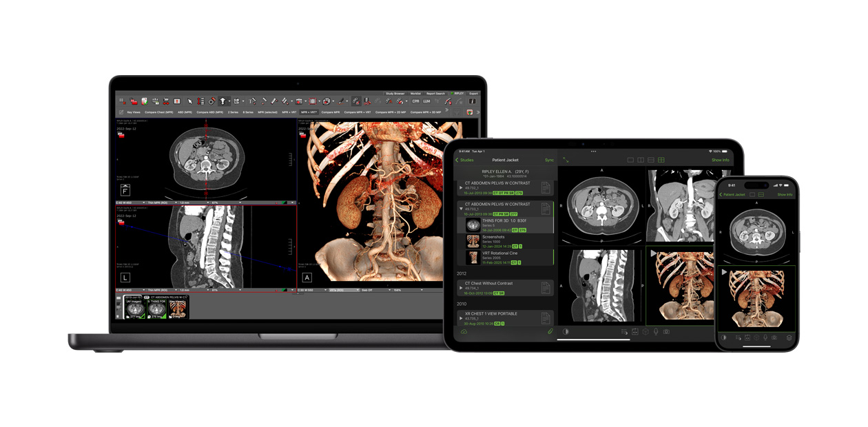 Software displaying the Visage app, which radiologists use to interpret large diagnostic files.